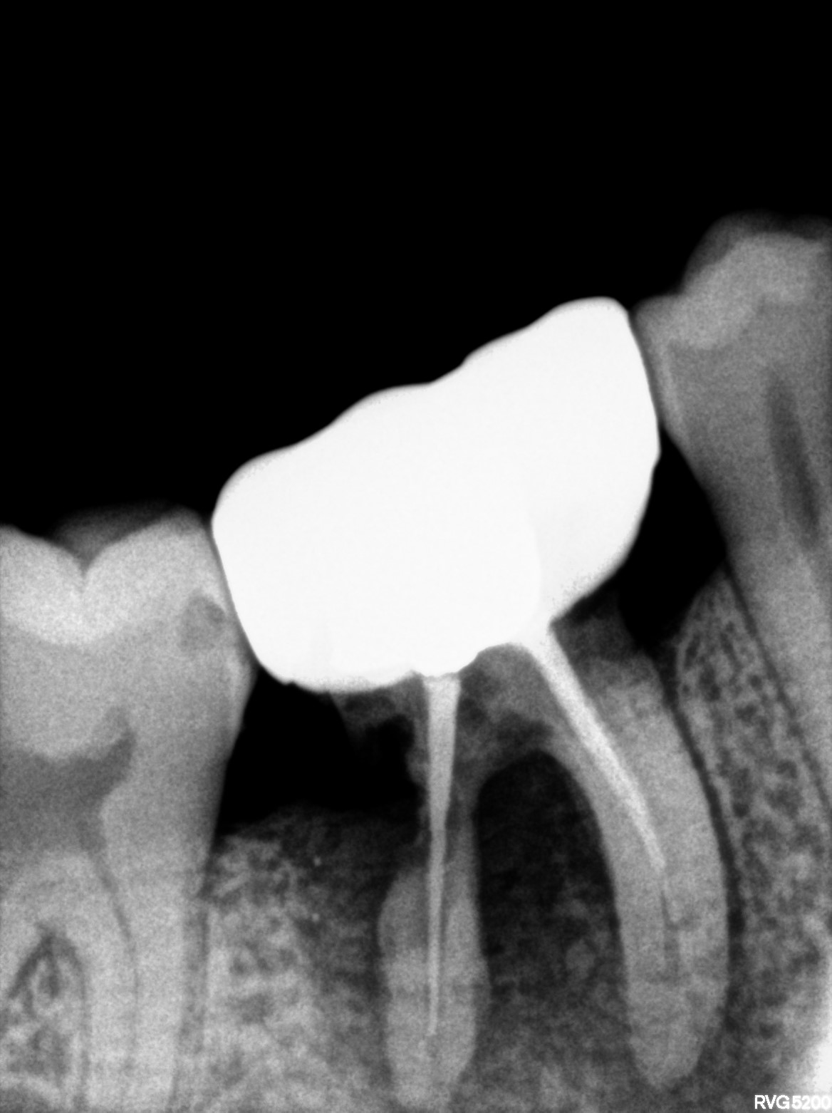 Dental X-ray